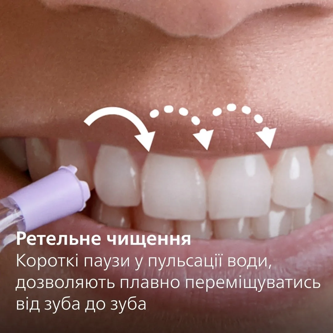 Ирригатор Philips HX3911/40 — фото 7